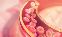 Isolated Systolic Hypertension
