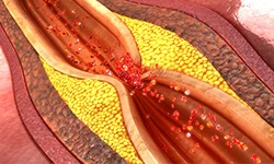 Causes_compressed
