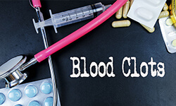 Formation Of Blood Clots