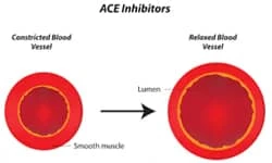 ACE-Inhibitors