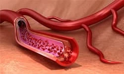 Blood Vessel Dilators (Vasodilators)