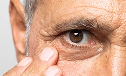 05_Eye-conditions_compressed